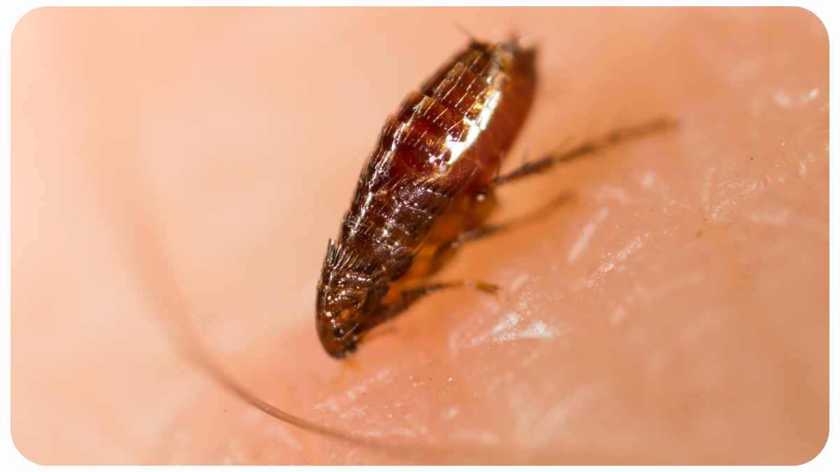 How To Get Rid Of Fleas On Humans Expert Answer 1