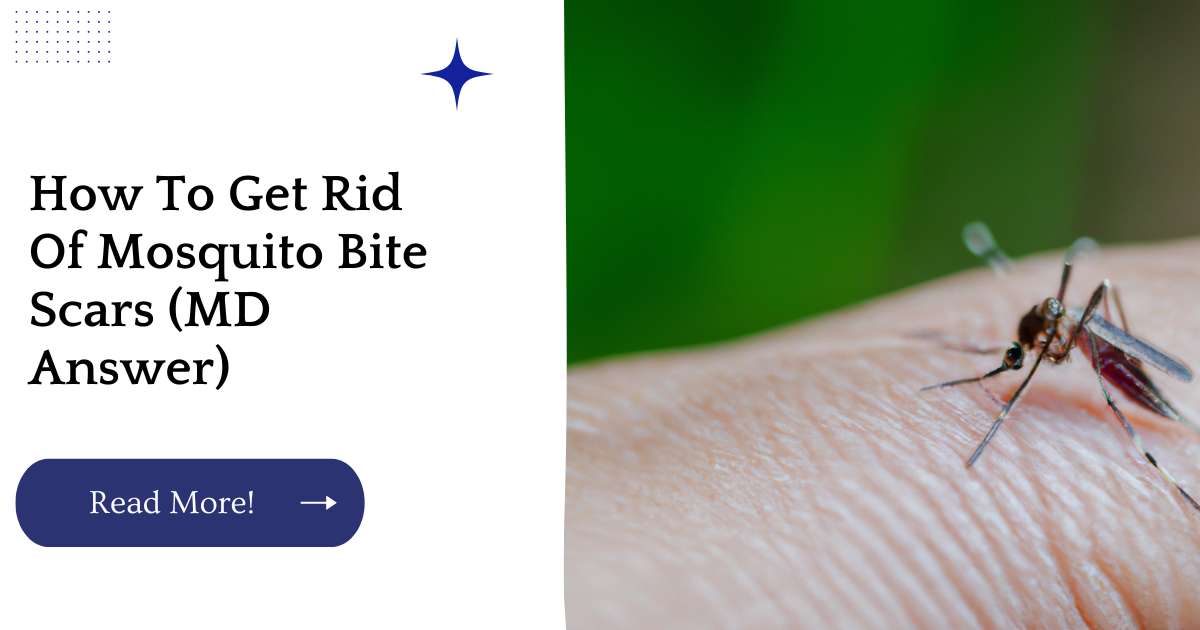 How To Get Rid Of Mosquito Bite Scars (MD Answer)