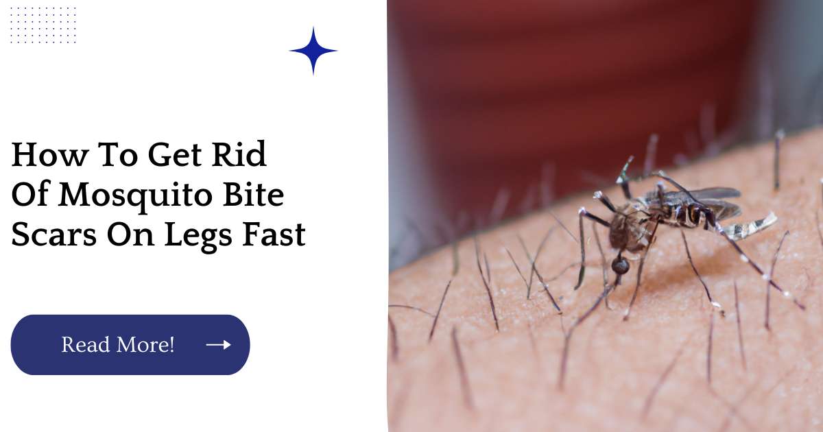 How To Get Rid Of Mosquito Bite Scars On Legs Fast