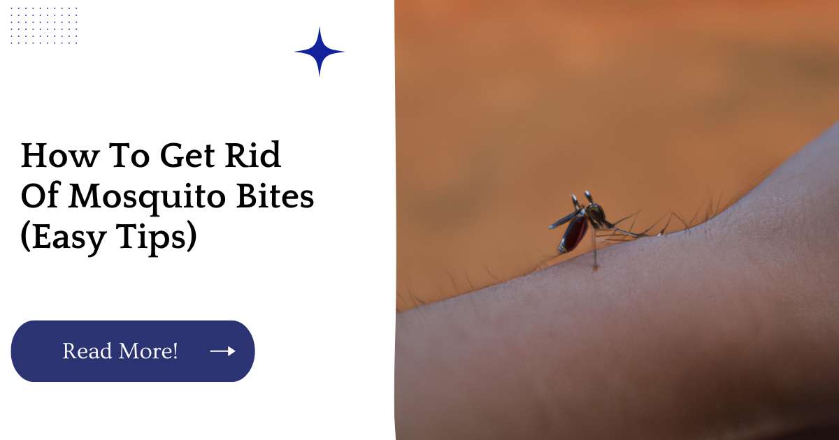 How To Get Rid Of Mosquito Bites (Easy Tips)