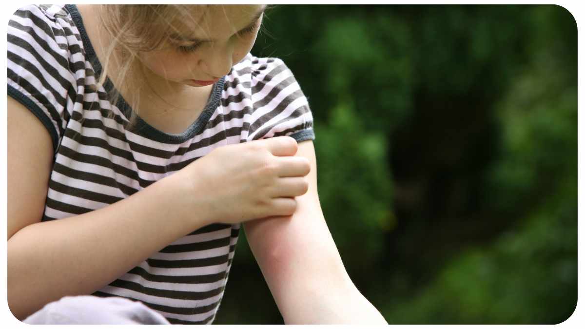 How To Get Rid Of Mosquito Bites Quickly