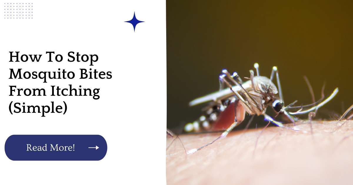 How To Stop Mosquito Bites From Itching (Simple)