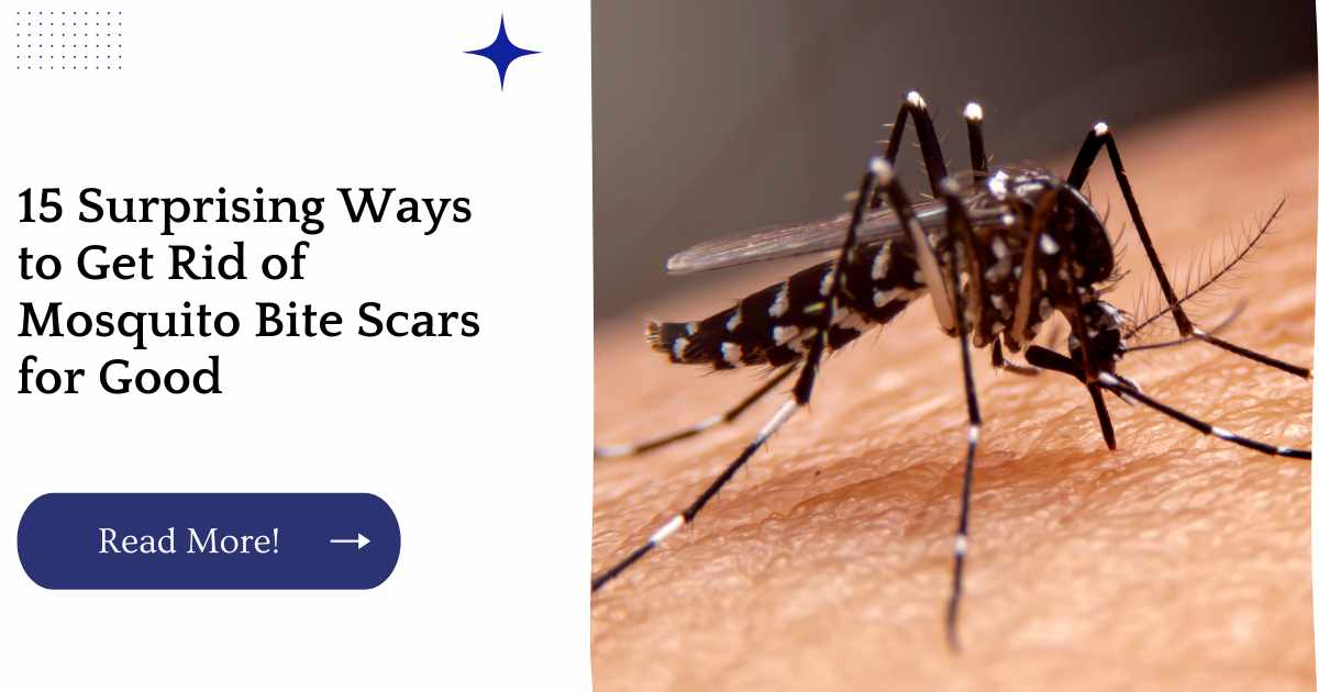 15 Surprising Ways to Get Rid of Mosquito Bite Scars for Good