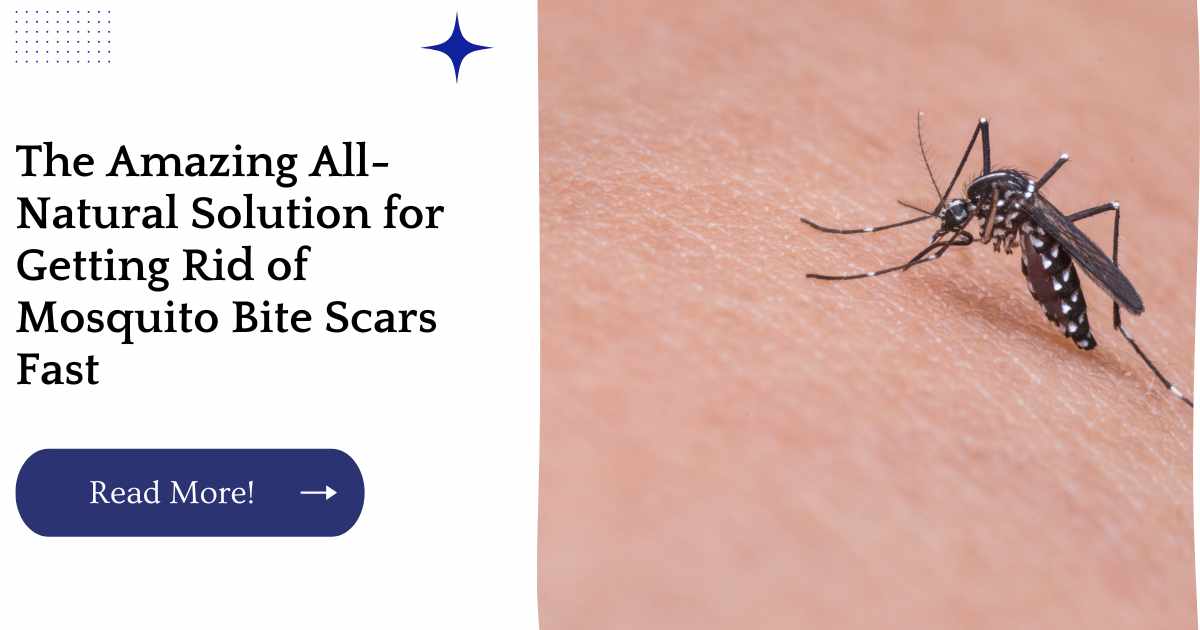 The Amazing All-Natural Solution for Getting Rid of Mosquito Bite Scars Fast