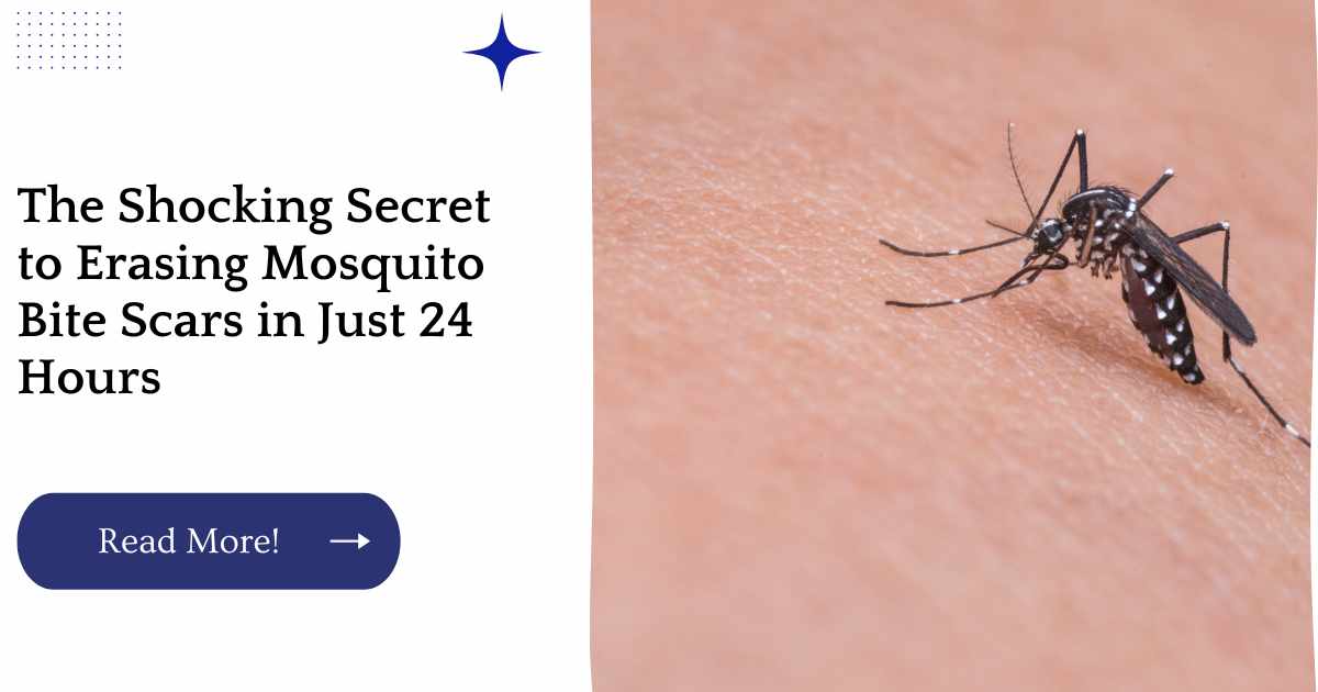 The Shocking Secret to Erasing Mosquito Bite Scars in Just 24 Hours